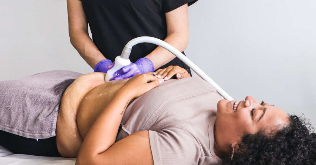 What Is Cryoskin? 